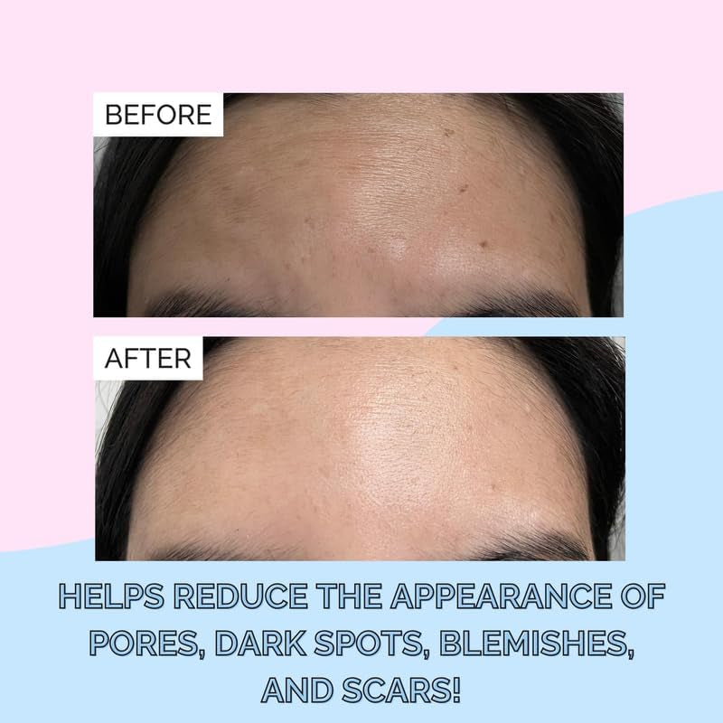 Korean Snail Mucin Serum β Deep Hydration & Skin Repair, 97% Snail Mucin, 100ml β Anti-Aging, Fast-Absorbing, Cruelty-Free, Dermatologist & Allergy Tested